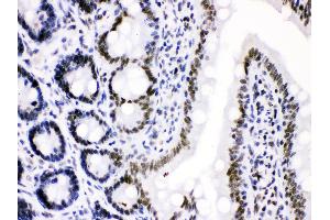 Anti- Cdk9 Picoband antibody, IHC(P) IHC(P): Rat Intestine Tissue
