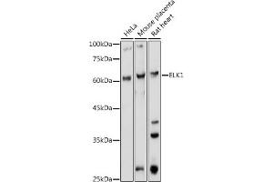 Western blot analysis of extracts of various cell lines, using ELK1 antibody (ABIN1679704, ABIN3015328, ABIN3015329 and ABIN6213987) at 1:1000 dilution. (ELK1 抗体  (AA 90-250))