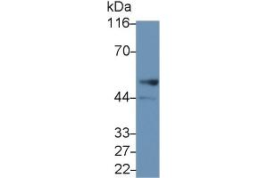Detection of LSP1 in Human Lung lysate using Polyclonal Antibody to Lymphocyte Specific Protein 1 (LSP1) (LSP1 抗体  (AA 127-331))