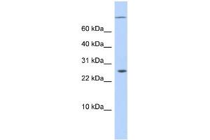 WB Suggested Anti-ARID5A Antibody Titration:  0. (ARID5A 抗体  (N-Term))