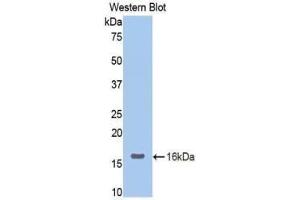 Western blot analysis of the recombinant protein. (Neuropilin 1 抗体  (AA 147-265))
