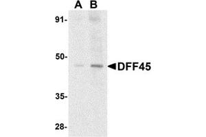 Western Blotting (WB) image for anti-DNA Fragmentation Factor, 45kDa, alpha Polypeptide (DFFA) (N-Term) antibody (ABIN1031352) (DFFA 抗体  (N-Term))