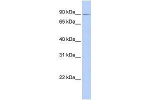 WB Suggested Anti-XYLT2 Antibody Titration:  0. (XYLT2 抗体  (C-Term))