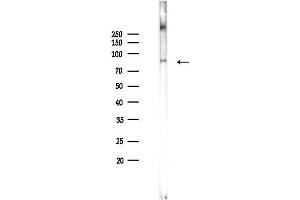 Western blot analysis of lysates from K562 cells(heat-shock 45 min treatment), using Phospho-Mitofusin 2 (Ser442) Antibody at 1/1000 dilution.