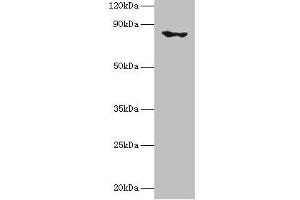 Western blot All lanes: EHHADH antibody at 2 μg/mL + Mouse kidney tissue Secondary Goat polyclonal to rabbit IgG at 1/10000 dilution Predicted band size: 80, 70 kDa Observed band size: 80 kDa (EHHADH 抗体  (AA 1-723))