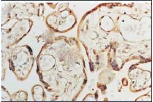 Image no. 1 for anti-Superoxide Dismutase 1, Soluble (SOD1) antibody (ABIN264856) (SOD1 抗体)