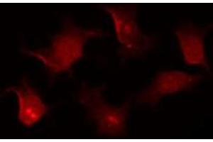 Immunofluorescence (fixed cells) (IF/ICC) image for anti-Receptor tyrosine-protein kinase erbB-2 (ErbB2/Her2) (pTyr1248) antibody (ABIN6256630)