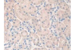 Detection of CHRM1 in Rat Kidney Tissue using Polyclonal Antibody to Cholinergic Receptor, Muscarinic 1 (CHRM1)