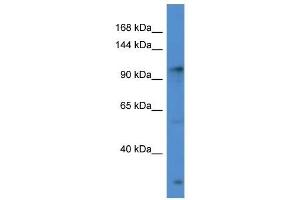 Western Blot showing GABBR2 antibody used at a concentration of 1 ug/ml against Hela Cell Lysate (GABBR2 抗体  (C-Term))