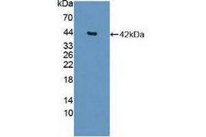 Western blot analysis of recombinant Human HDAC9. (HDAC9 抗体  (AA 23-343))
