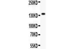 Anti- ZEB2antibody, Western blotting All lanes: Anti ZEB2  at 0. (ZEB2 抗体  (AA 1-200))