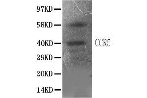 Anti-CCR5 antibody, IHC(P)All lanes: Anti CCR5  at 0. (CCR5 抗体  (N-Term))