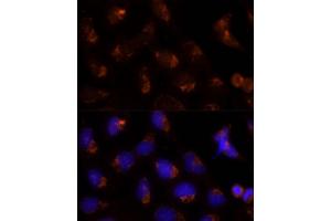 Immunofluorescence analysis of U-2 OS cells using SEC14L2 Polyclonal Antibody (ABIN6132639, ABIN6147484, ABIN6147485 and ABIN6214889) at dilution of 1:100 (40x lens). (SEC14L2 抗体  (AA 60-270))