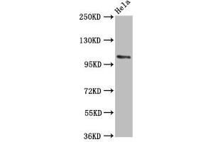 Western Blot Positive WB detected in: Hela whole cell lysate All lanes: PAM antibody at 5. (PAM 抗体  (AA 338-497))