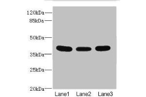 Western blot All lanes: CD1C antibody at 3. (CD1c 抗体  (AA 18-300))