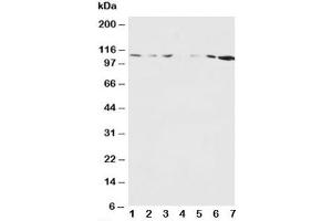 Western blot testing of NMDAR1 antibody and Lane 1:  rat brain (GRIN1/NMDAR1 抗体  (N-Term))