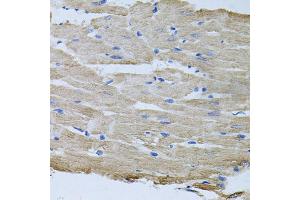 Immunohistochemistry of paraffin-embedded rat heart using TARS antibody (ABIN5974207) at dilution of 1/100 (40x lens). (TARS 抗体)