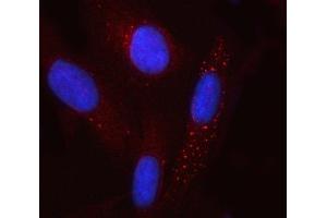 IF analysis of GCM1 using anti-GCM1 antibody (ABIN7600391).