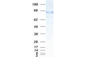 Western Blotting (WB) image for Antigen P97 (Melanoma Associated) Identified By Monoclonal Antibodies 133.2 and 96.5 (MFI2) (Transcript Variant 1) protein (Myc-DYKDDDDK Tag) (ABIN2713518)