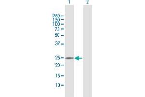 Western Blot analysis of RAB37 expression in transfected 293T cell line by RAB37 MaxPab polyclonal antibody. (RAB37 抗体  (AA 1-223))