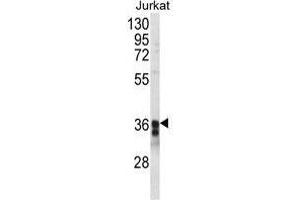 Western blot analysis of TM173 Antibody (C-term) in Jurkat cell line lysates (35 µg/lane). (STING/TMEM173 抗体  (C-Term))