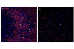 Expression of Neuronal Pentraxin Receptor in rat hippocampus. (NPTXR 抗体  (C-Term, Extracellular))