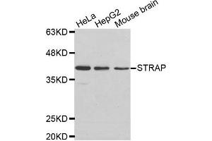 Western Blotting (WB) image for anti-Serine/threonine Kinase Receptor Associated Protein (STRAP) antibody (ABIN1876993) (STRAP 抗体)