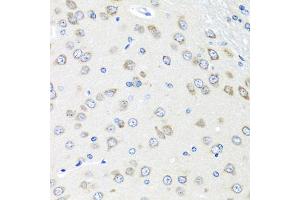 Immunohistochemistry of paraffin-embedded rat brain using PIAS3 antibody (ABIN5974247) at dilution of 1/100 (40x lens). (PIAS3 抗体)