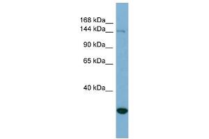 WB Suggested Anti-JARID2 Antibody Titration: 0. (JARID2 抗体  (N-Term))