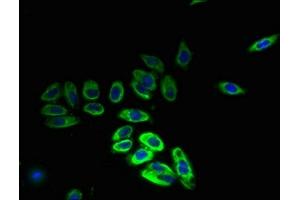 Immunofluorescent analysis of HepG2 cells using ABIN7155229 at dilution of 1:100 and Alexa Fluor 488-congugated AffiniPure Goat Anti-Rabbit IgG(H+L) (HIATL1 抗体  (AA 450-506))