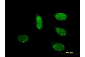 Immunofluorescence of monoclonal antibody to CRSP6 on HeLa cell. (MED17 抗体  (AA 551-651))