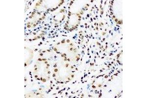 Immunohistochemical analysis of HRP2 staining in human stomach formalin fixed paraffin embedded tissue section. (HDGFRP2 抗体)