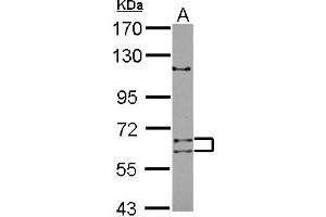 Western Blotting (WB) image for anti-Adenosine Deaminase Domain Containing 1 (Testis-Specific) (ADAD1) (AA 1-307) antibody (ABIN1496470) (ADAD1 抗体  (AA 1-307))