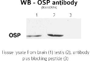 Image no. 2 for anti-Claudin 11 (CLDN11) (C-Term) antibody (ABIN346949) (Claudin 11 抗体  (C-Term))