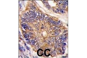 Immunohistochemistry (Paraffin-embedded Sections) (IHC (p)) image for anti-Low Density Lipoprotein Receptor Adaptor Protein 1 (LDLRAP1) (AA 11-42), (N-Term) antibody (ABIN392553)