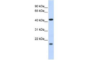 ING3 antibody used at 1 ug/ml to detect target protein. (ING3 抗体  (Middle Region))