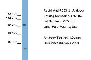 WB Suggested Anti-PCDH21  Antibody Titration: 0. (PCDH21 抗体  (N-Term))