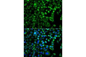 Immunofluorescence analysis of A549 cells using ZAK antibody. (ZAK 抗体)