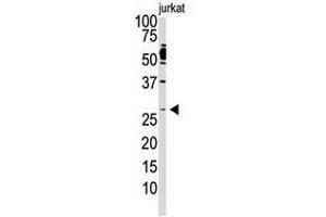 Image no. 1 for anti-Dickkopf 2 Homolog (DKK2) (C-Term) antibody (ABIN357070) (DKK2 抗体  (C-Term))