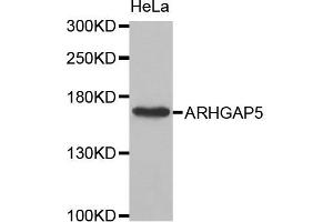Western Blotting (WB) image for anti-rho GTPase Activating Protein 5 (ARHGAP5) antibody (ABIN1871080) (ARHGAP5 抗体)