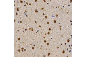 Immunohistochemistry (IHC) image for anti-Proline-, Glutamic Acid- and Leucine-Rich Protein 1 (PELP1) (AA 1021-1180) antibody (ABIN3023502)