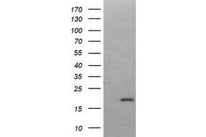 Image no. 1 for anti-LIM Domain Only 2 (Rhombotin-Like 1) (LMO2) antibody (ABIN1499188) (LMO2 抗体)