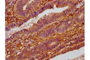Immunohistochemistry (IHC) image for anti-Zinc Finger CCCH-Type Containing 14 (ZC3H14) (AA 176-306) antibody (ABIN7176036)
