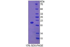 SDS-PAGE (SDS) image for CD59 (CD59) (AA 21-107) protein (His tag) (ABIN1525566) (CD59 Protein (CD59) (AA 21-107) (His tag))