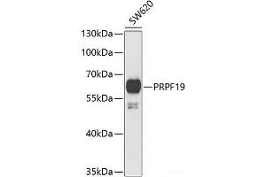 Western blot analysis of extracts of SW620 cells using PRPF19 Polyclonal Antibody at dilution of 1:1000. (PRP19 抗体)