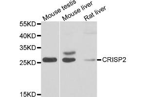 Western blot analysis of extracts of various cell lines, using CRISP2 antibody. (CRISP2 抗体)