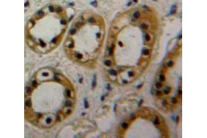 Used in DAB staining on fromalin fixed paraffin-embedded Kidney tissue (CAP1 抗体  (AA 38-149))