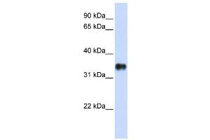 Western Blotting (WB) image for anti-Potassium Channel Tetramerisation Domain Containing 7 (KCTD7) antibody (ABIN2458146) (KCTD7 抗体)