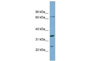 PDP2 antibody used at 1 ug/ml to detect target protein. (PDP2 抗体  (Middle Region))
