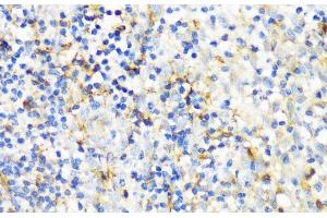 Immunohistochemistry of paraffin-embedded Human tonsil using ITGAX Polyclonal Antibody at dilution of 1:100 (40x lens). (CD11c 抗体)